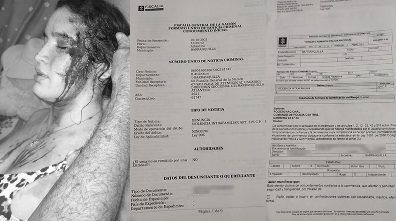 Joven que recibió brutal golpiza de su expareja