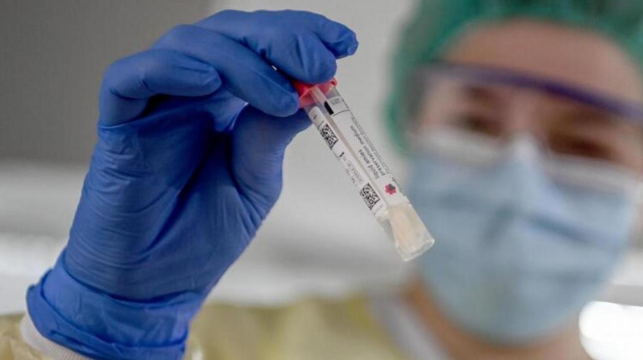 Laboratorios procesaron, según Minsalud, 41.165 pruebas en búsqueda de casos activos de Covid-19.