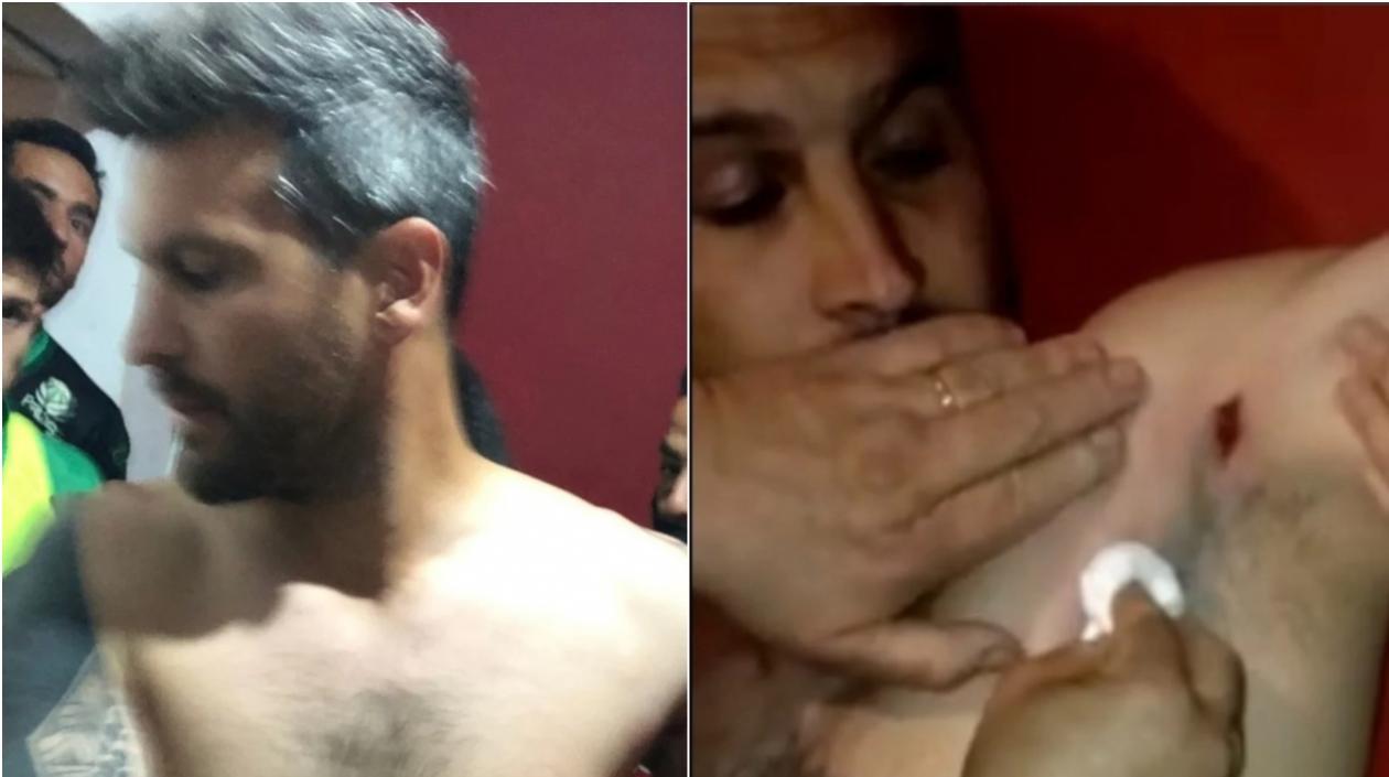 Mauricio Romero, técnico herido. 