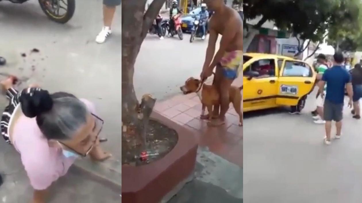 Ataque de un perro a una mujer
