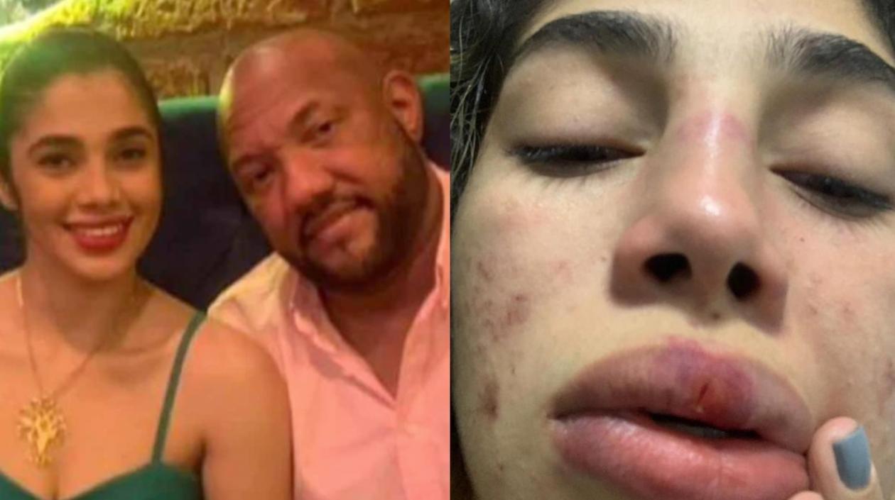 Fernanda Ariza y Alberto 'Tico' Mercado.