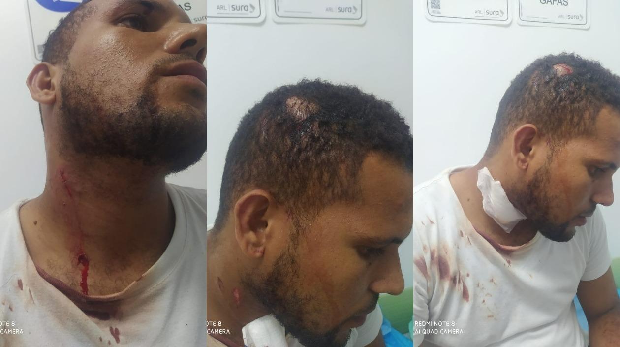 El árbitro Arlinton Ariza mostrando las violentas heridas recibidas.