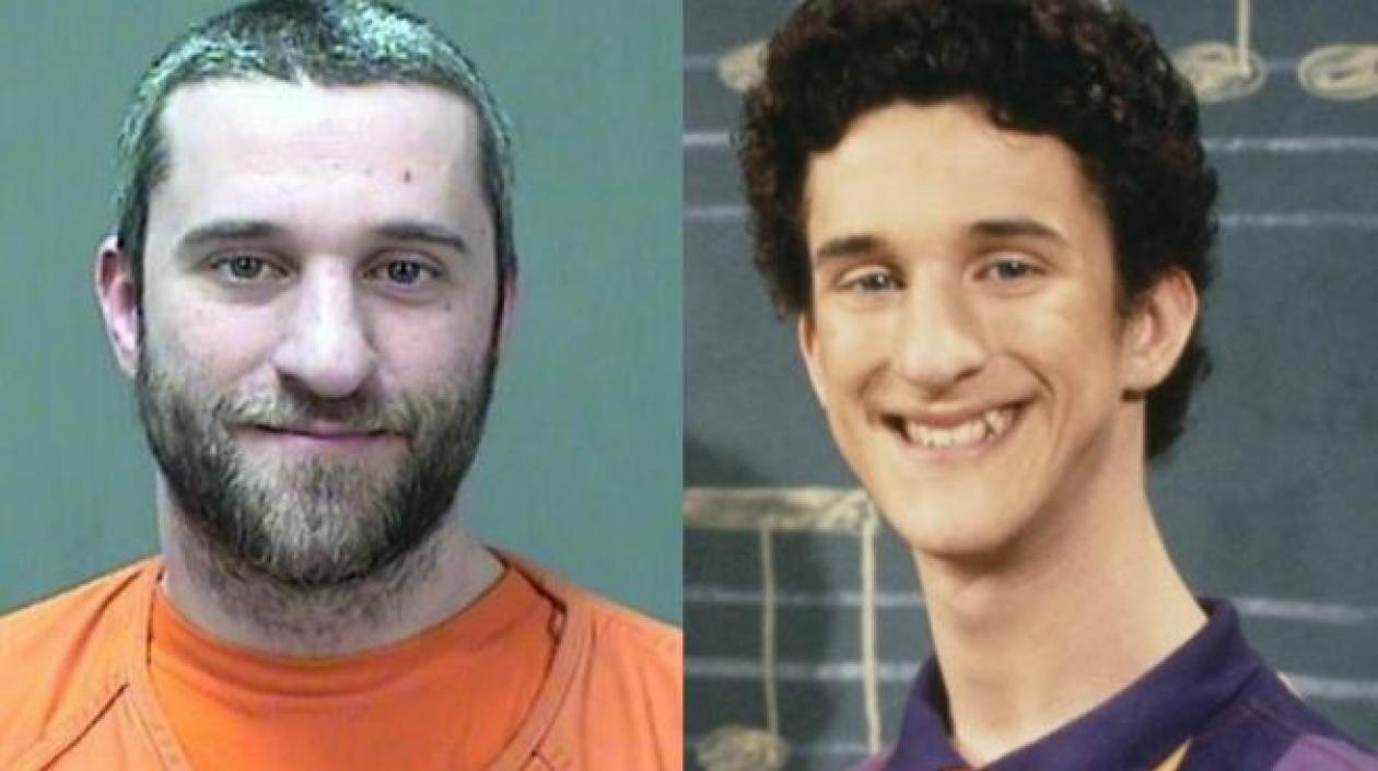 Actor estadounidense Dustin Diamond fallecido a los 44 años.