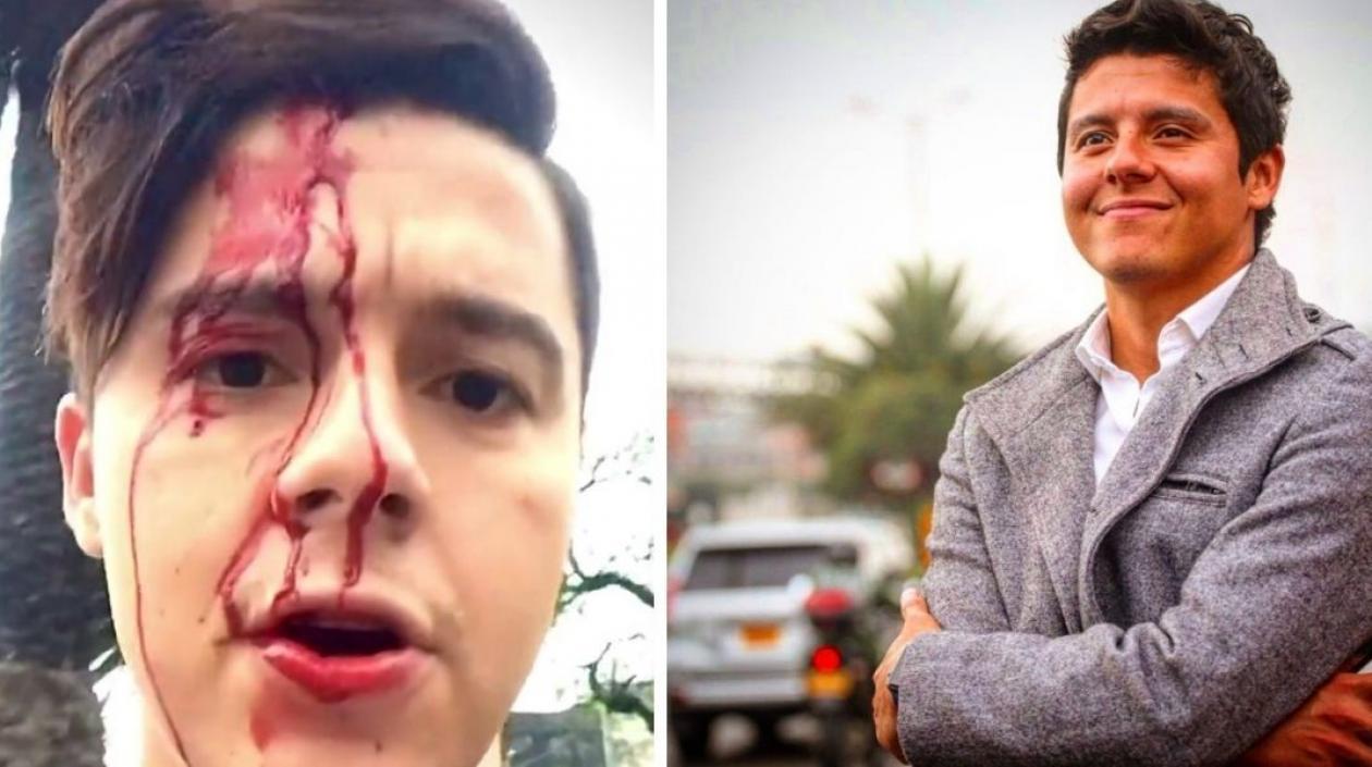 Así quedó el actor tras el ataque.