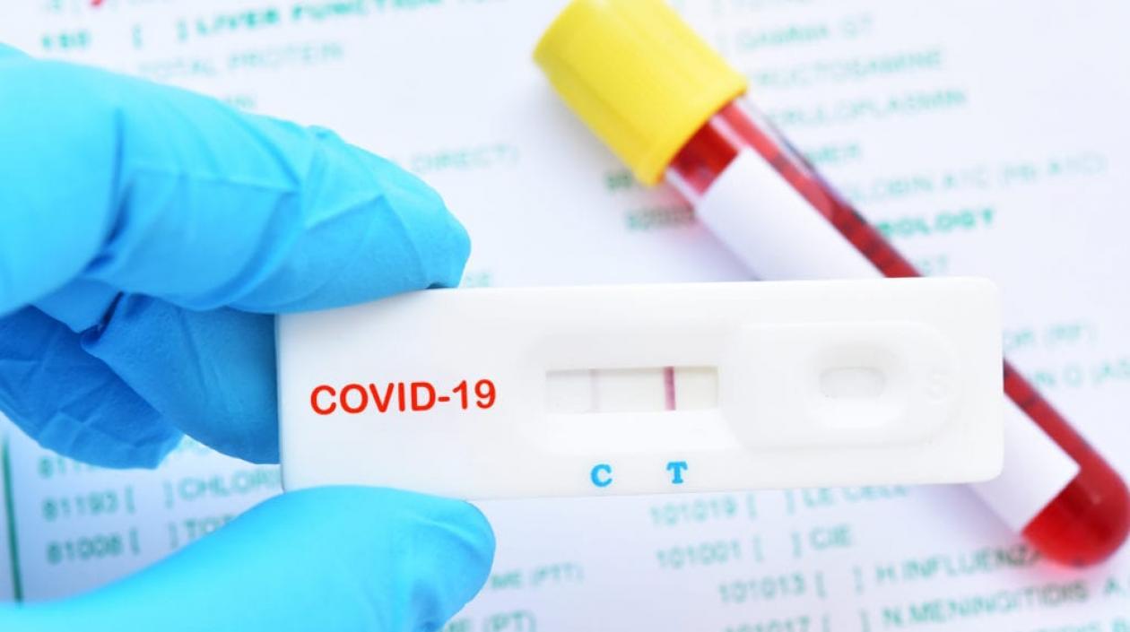 La prueba es con prescripción médica.