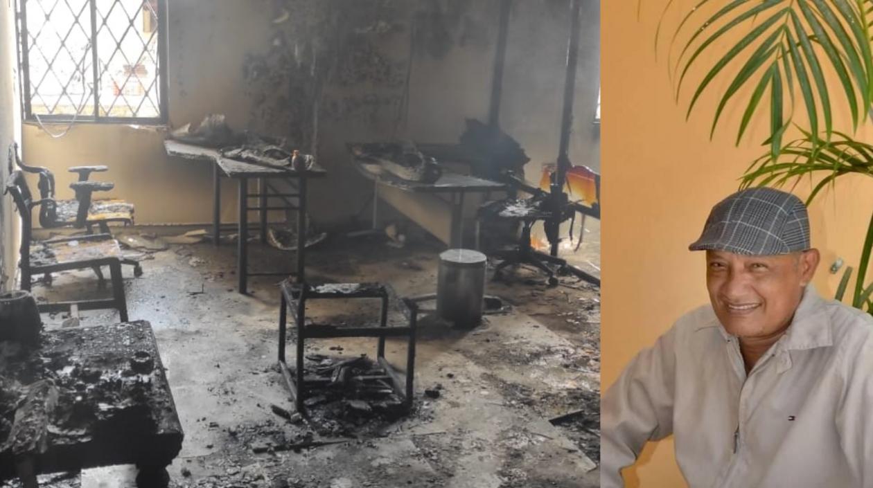 José Miguel Schiller Vizcaíno resultó quemado tras el incendio registrado en su oficina. 