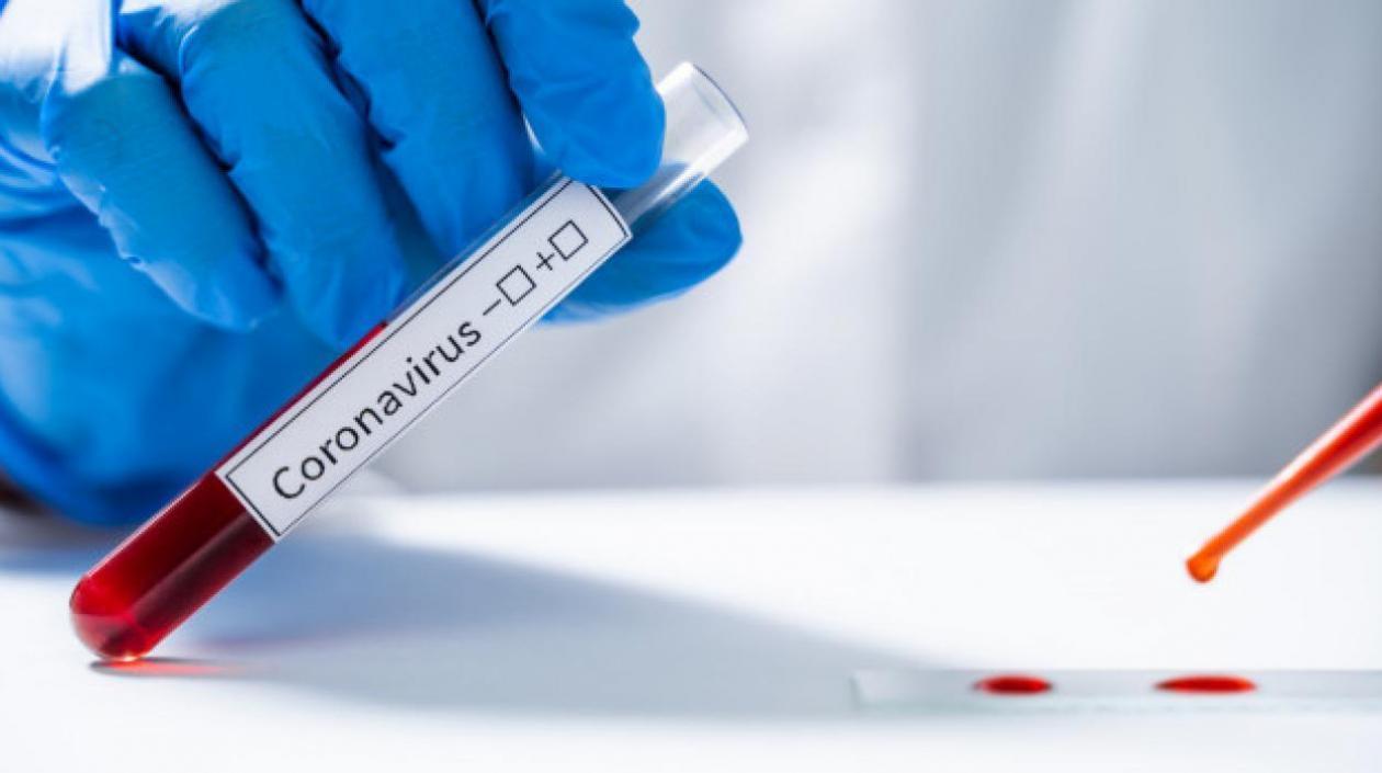 Siguen las pruebas para detectar el Covid-19.