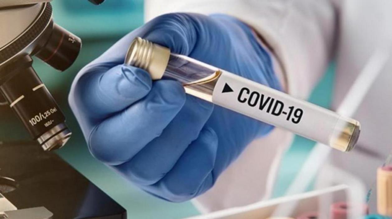 Siguen las pruebas de Covid-19 en Colombia, para detectar casos.