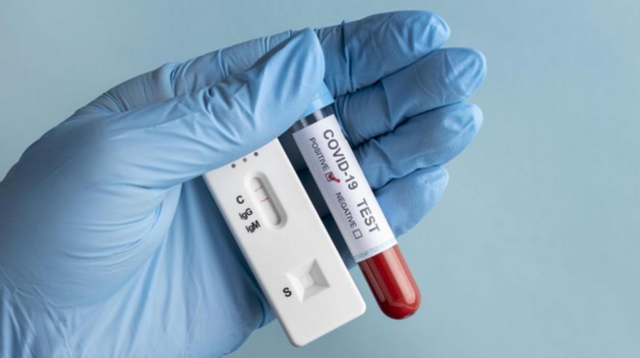 Las pruebas de PCR y de Antígenos siguen realizándose en Colombia.