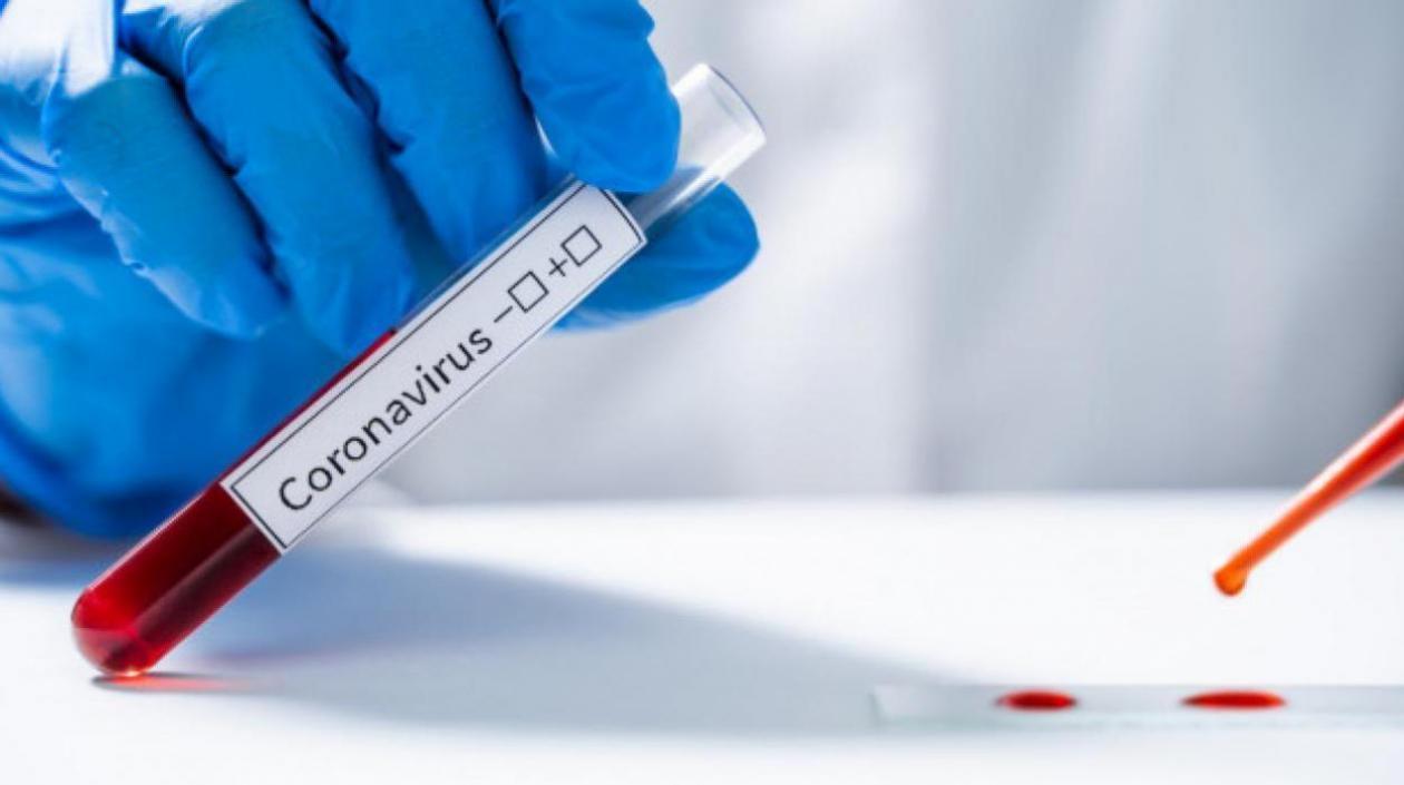 Laboratorios en el país procesaron 35.126 pruebas para detectar el Covid-19.