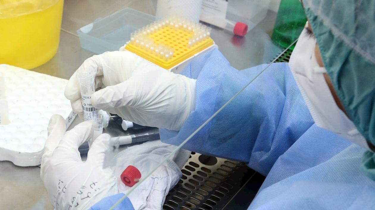 Específicamente, cuatro agencias de inteligencia de EE.UU. creen que el virus tiene origen animal, aunque tienen una "confianza baja" en esa idea.  