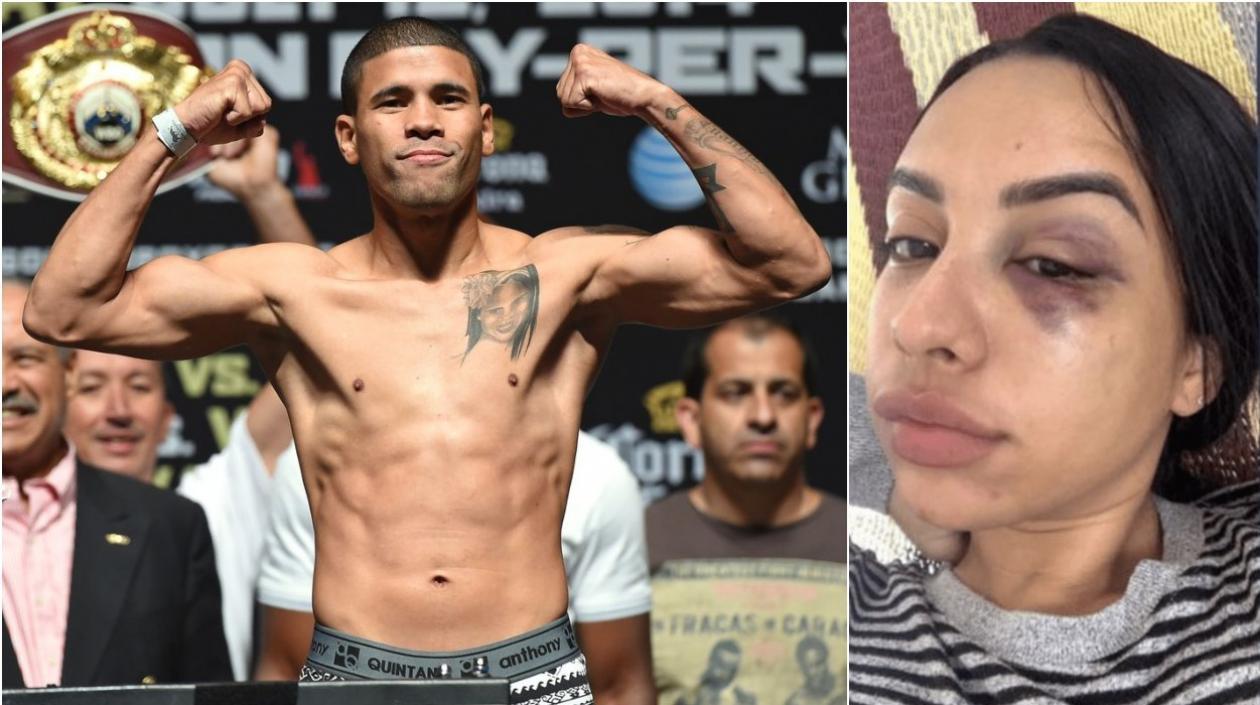 Juan Manuel López y Andrea Ojeda, luego de la supuesta agresión. 