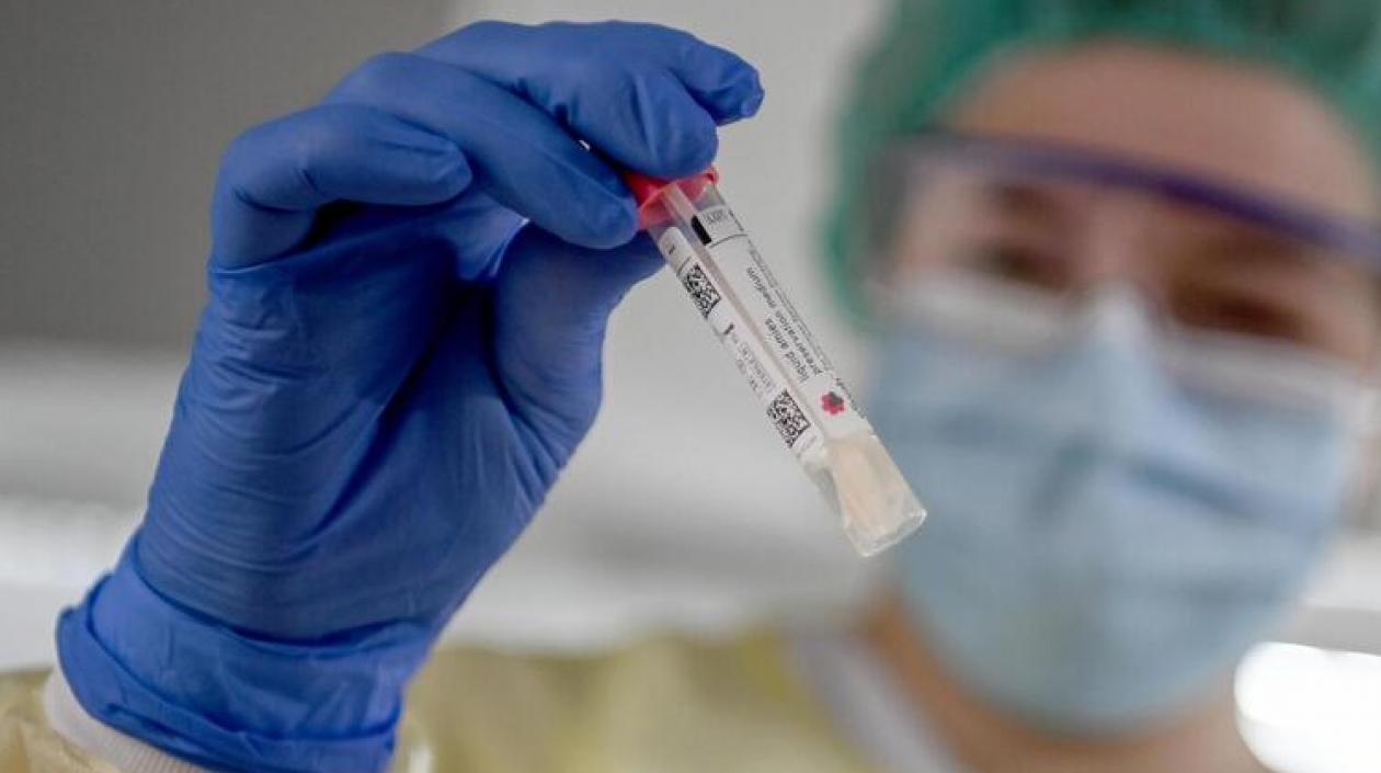 Laboratorios en el país procesaron 28.804 pruebas buscando el Covid-19.