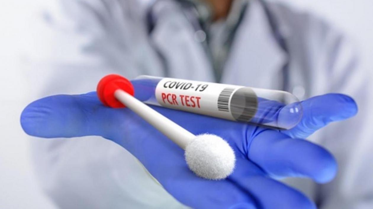 23.991 pruebas de PCR y 26.336 de Antígenos fueron procesadas en Colombia.