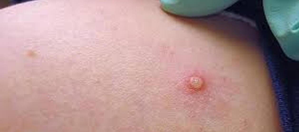 Imagen de referencia