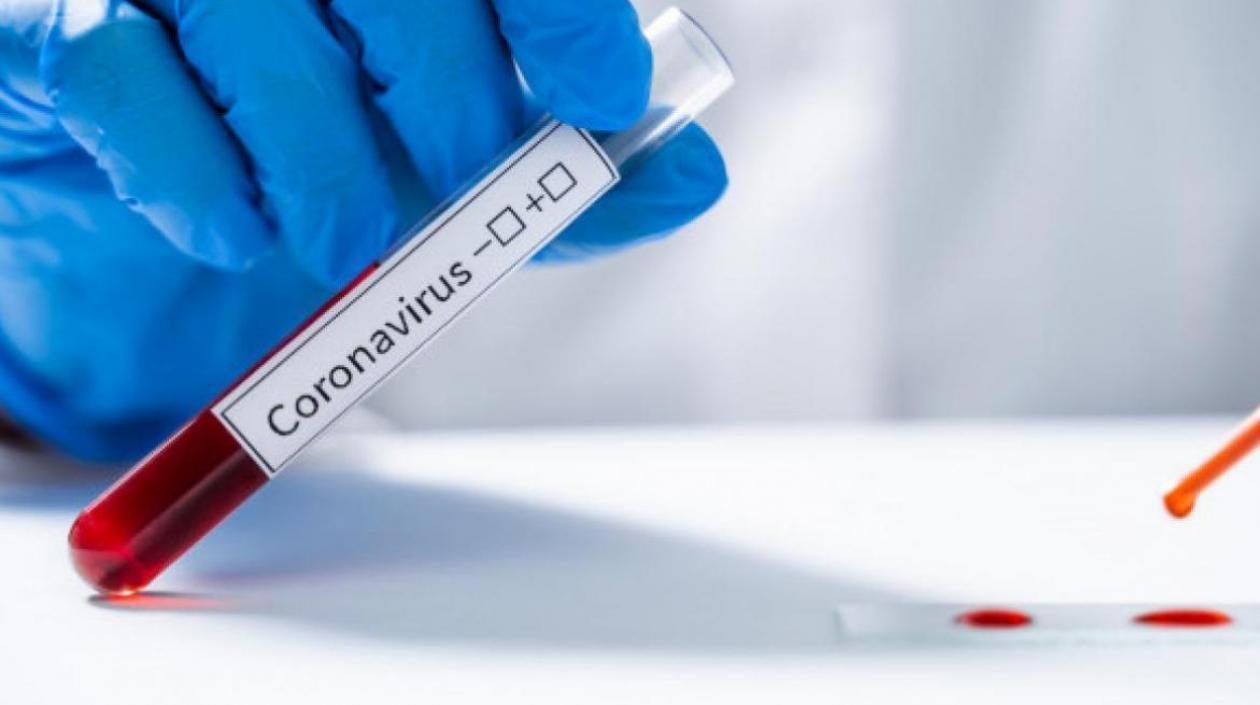 Hoy se procesaron 92.848 pruebas para detectar el Covid-19 en Colombia.