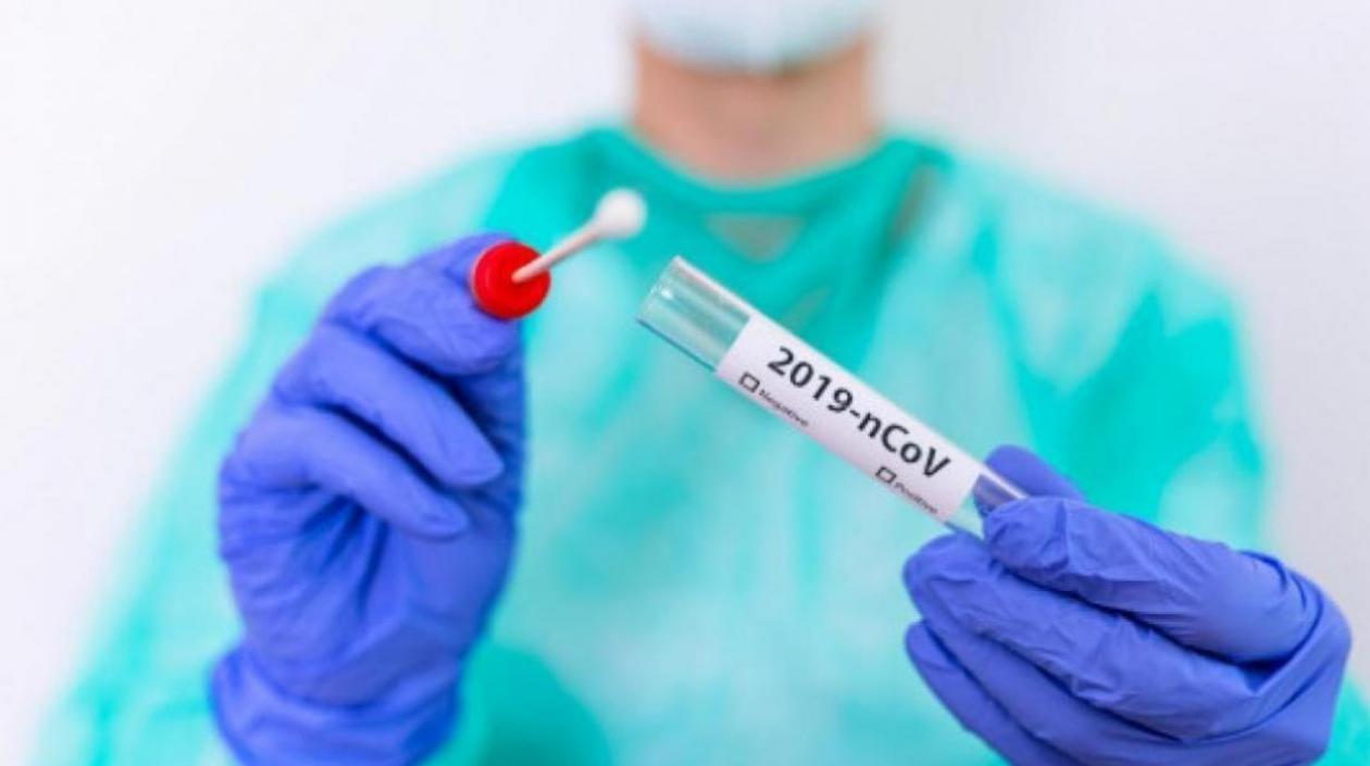 Las pruebas de Covid-19 en Colombia siguen realizándose con el lineamiento de Minsalud.