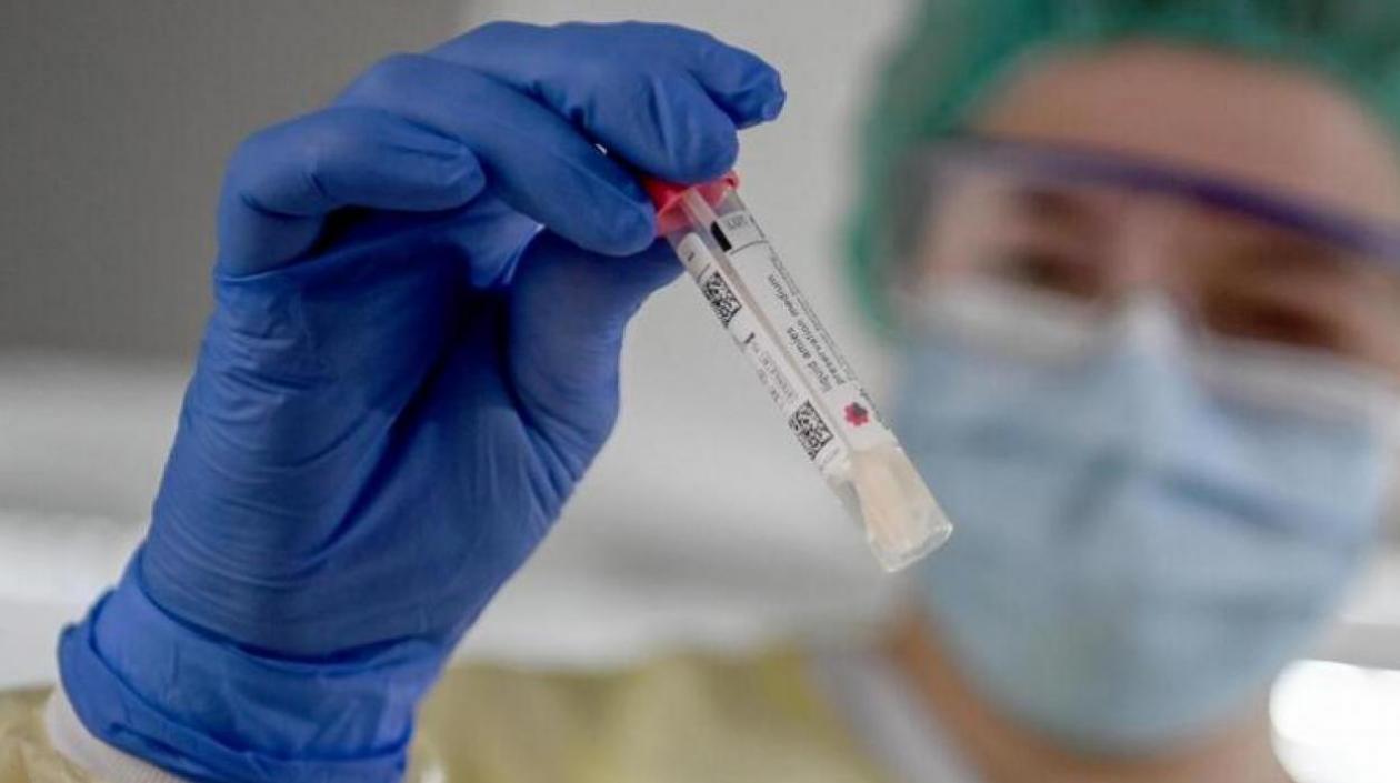 Las pruebas de Covid-19 reportadas fueron 68.610.