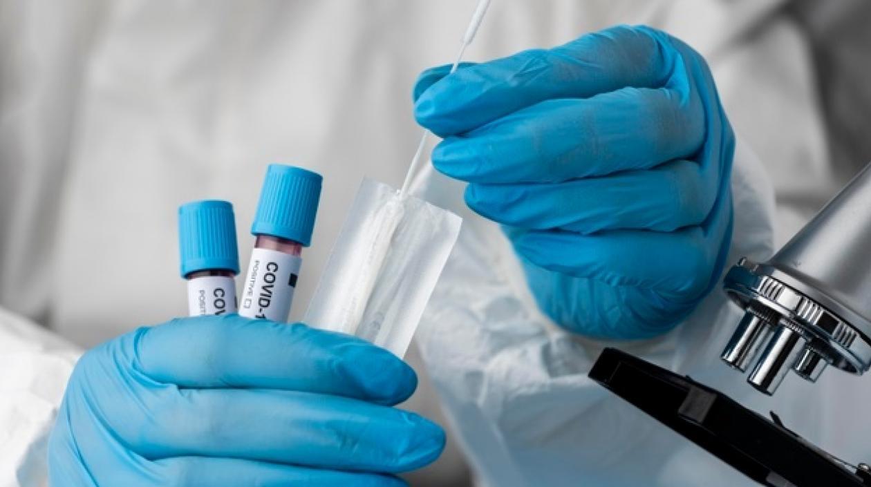 Los laboratorios colombianos procesaron 59.357 pruebas para detectar el Covid-19.