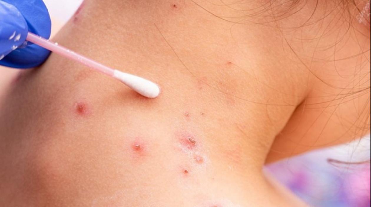 Imagen de referencia.