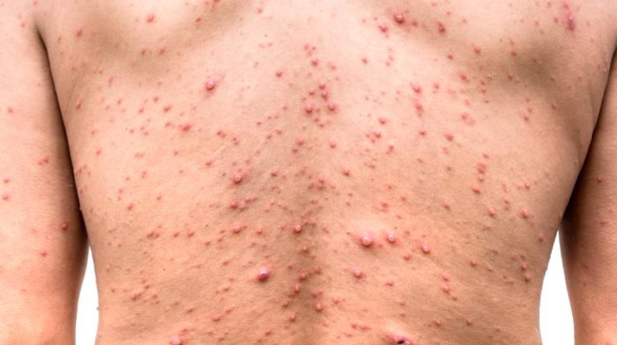 Imagen de referencia.