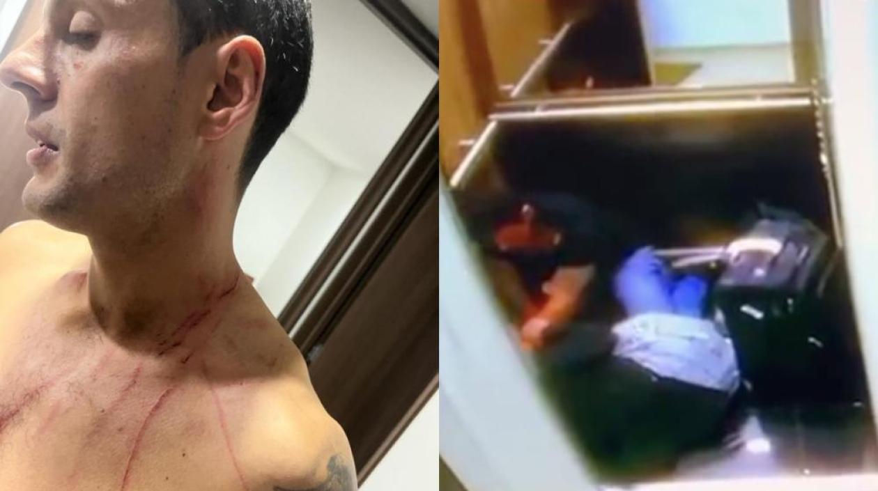 El periodista Juan Fernando Barona y el ataque a su expareja.