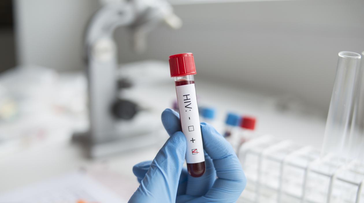 Investigación contra el sida.