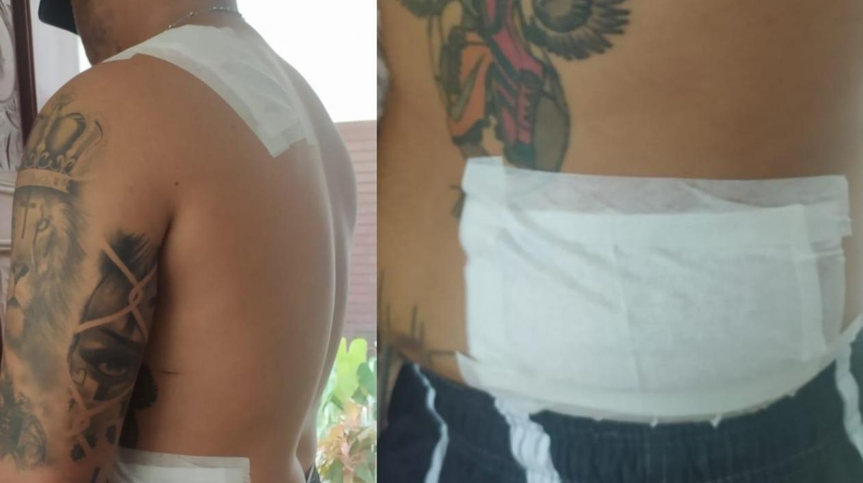 Zona donde fue apuñalado el hombre por los ladrones. 