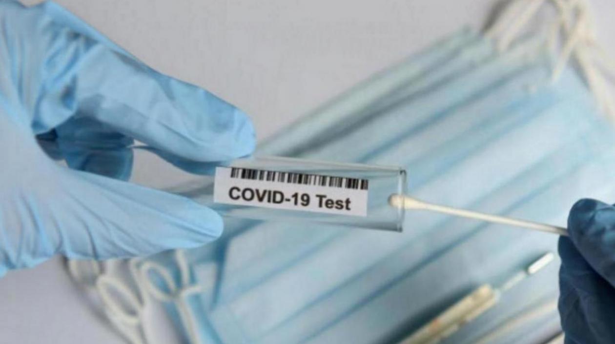 Laboratorios colombianos han procesado, según datos de Minsalud, más de 20 millones de pruebas para detectar el Covid-19.