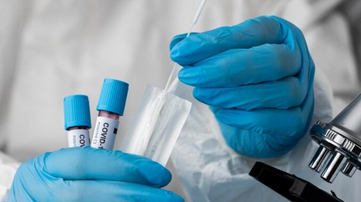 Las pruebas en las últimas 24 horas para detectar el coronavirus fueron 27.072.