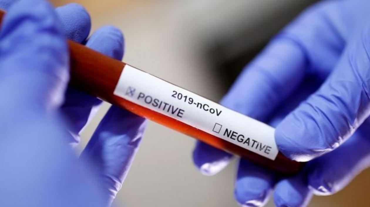 Las pruebas de Covid-19 en Colombia ascendieron a 21.368.