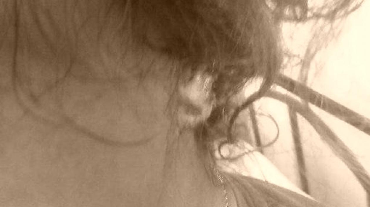  Así quedó la oreja de la mujer, que es atendida en la red pública.