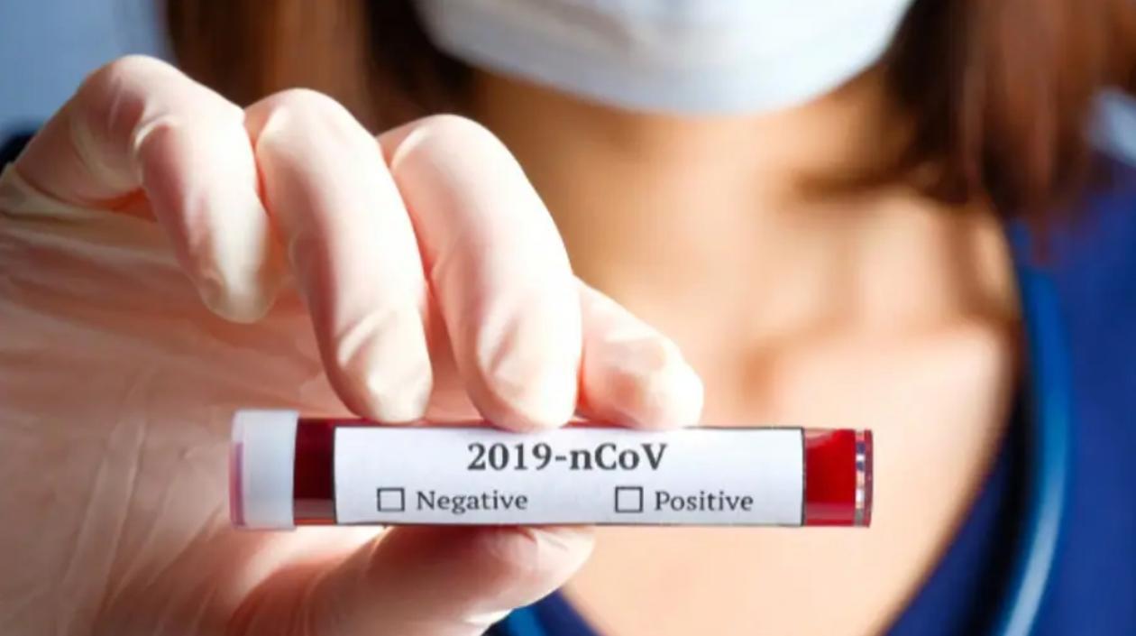 Casos de Covid-19 fueron 251 en Colombia.