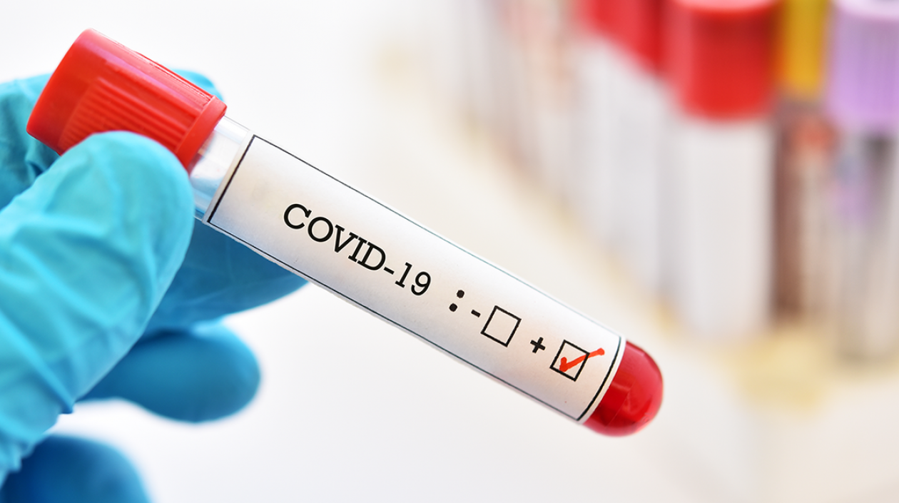 El Covid-19 sigue aún en Colombia.