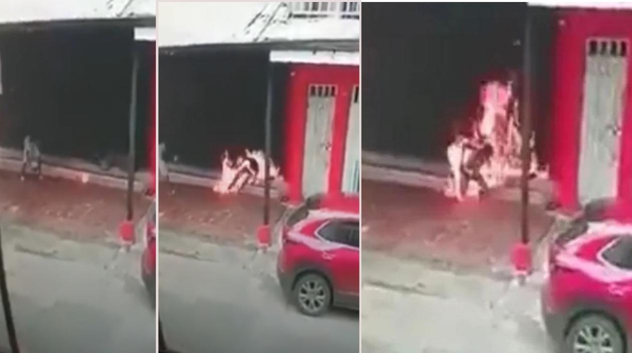 Este hombre fue quemado mientras dormía.