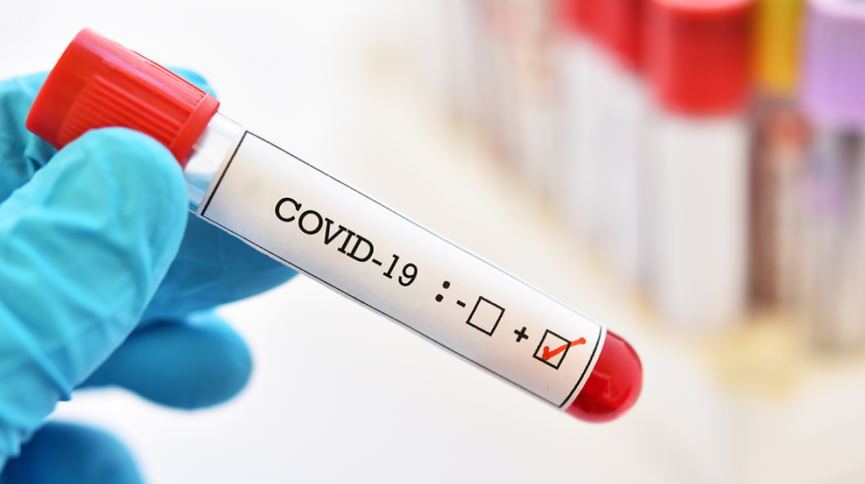 Siguen las pruebas para detectar el Covid-19.