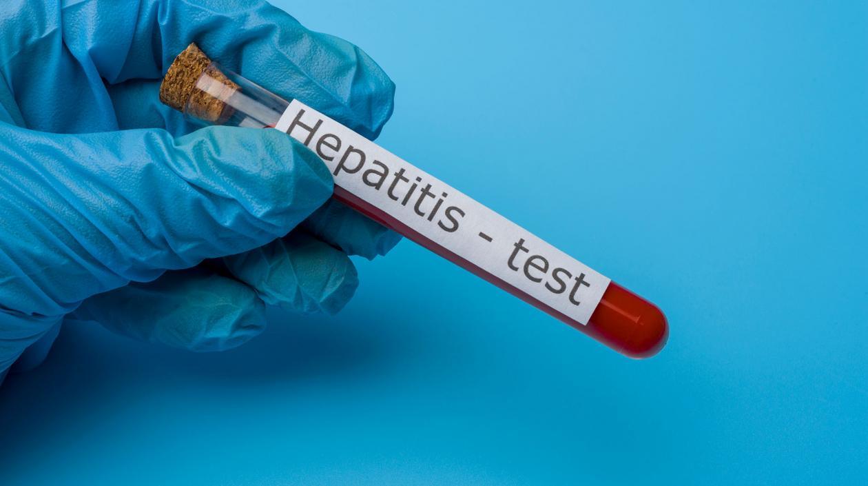 Gobierno colombiano adelante vigilancia pública a esta alerta internacional.