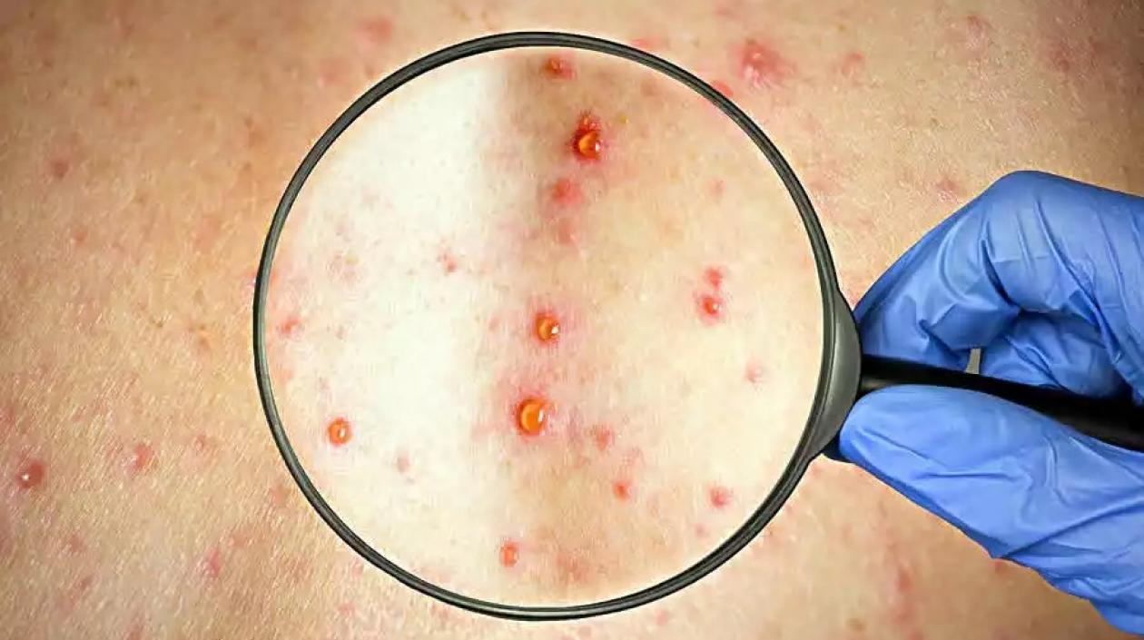 Imagen de referencia.