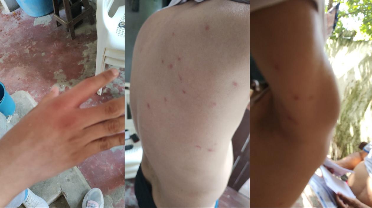 Estudiantes atacados por abejas africanizadas. 