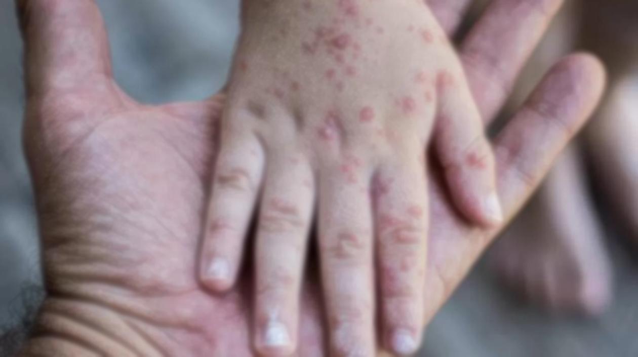 Imagen de referencia.