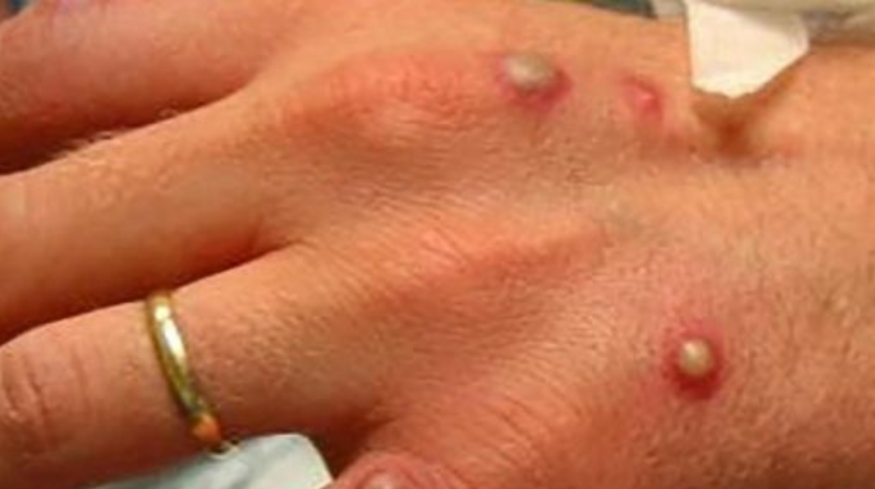 Imagen de referencia.