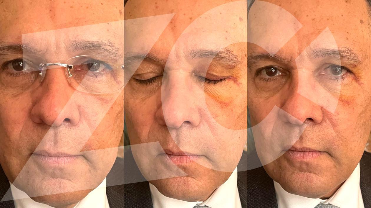 Las lesiones causadas al Senador Efraín Cepeda Sarabia.