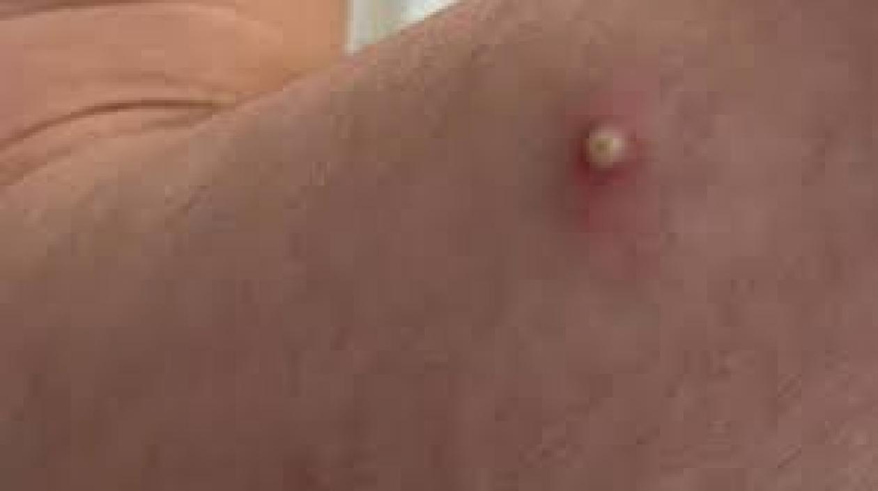 Imagen de referencia.