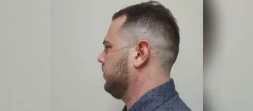 John Poulos presenta marcas de rasguños en su cara y cuello.