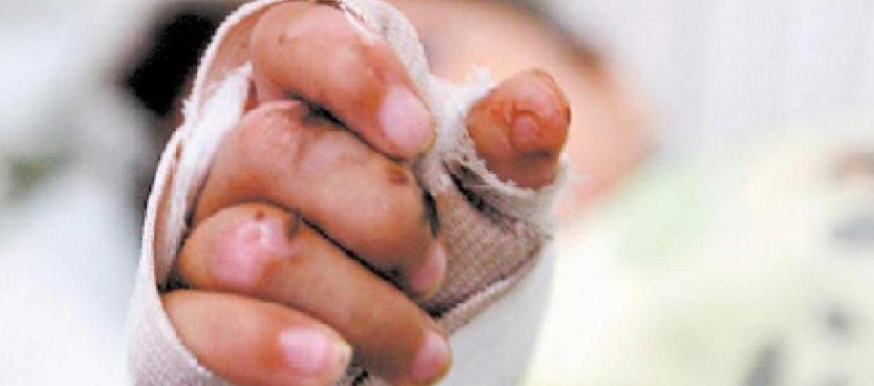 Imagen de referencia.