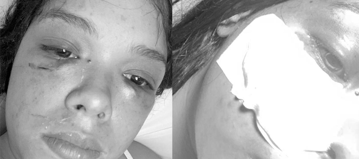 Así quedó la mujer tras la violenta agresión de su pareja. 