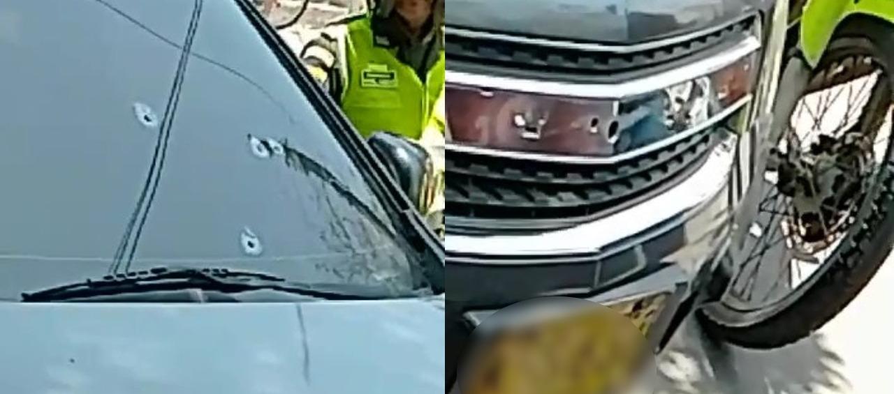  Un hombre herido deja ataque a bala en San José