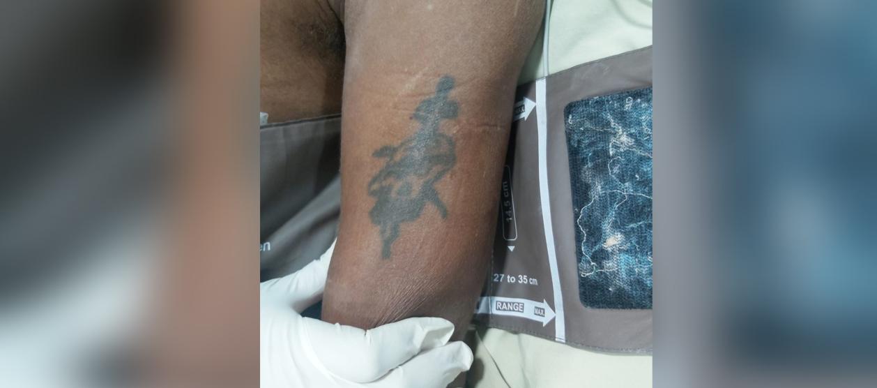 Brazo izquierdo del paciente