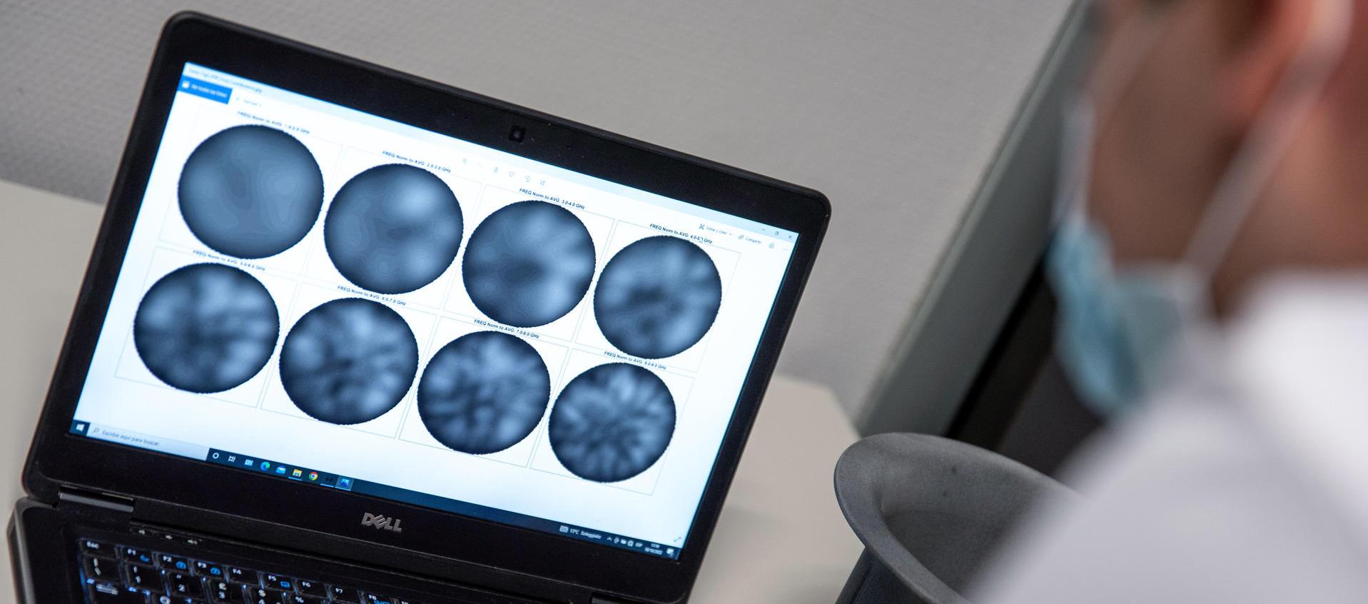 Desarrollo de nuevas moléculas para detectar el cáncer.