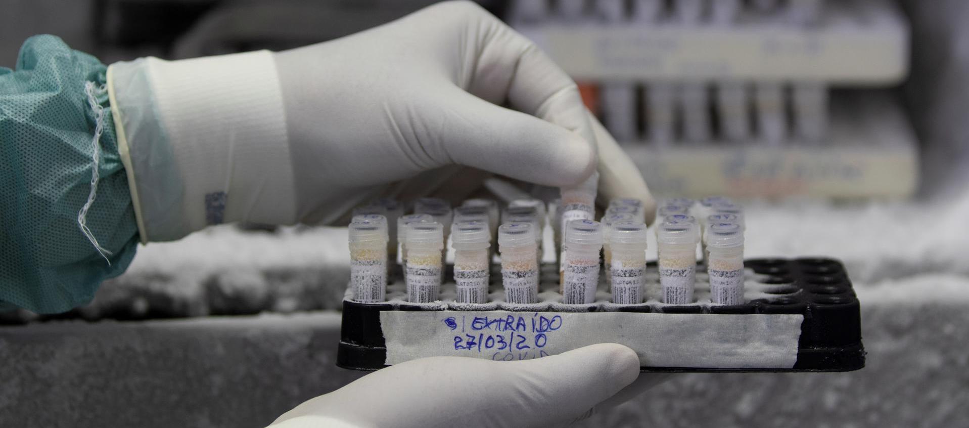 Muestras de laboratorio